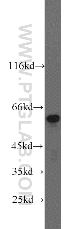 Western Blot (WB) analysis of rat liver tissue using Catalase Polyclonal antibody (21260-1-AP)