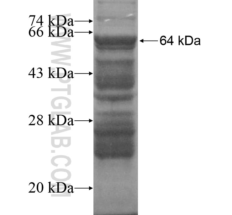 Catalase fusion protein Ag15383 SDS-PAGE