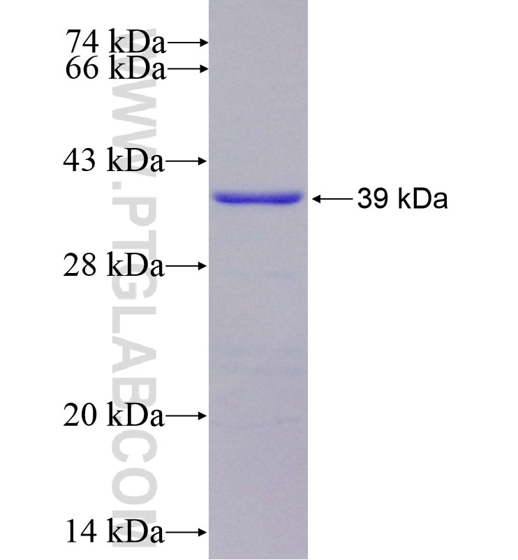 Catalase fusion protein Ag16916 SDS-PAGE