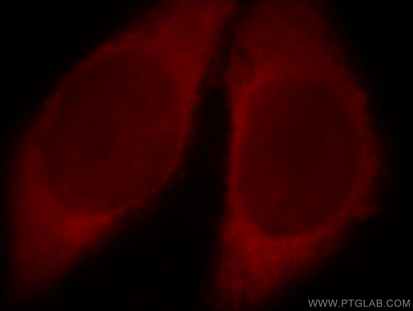 Immunofluorescence (IF) / fluorescent staining of HeLa cells using Catalase-Specific Polyclonal antibody (19792-1-AP)