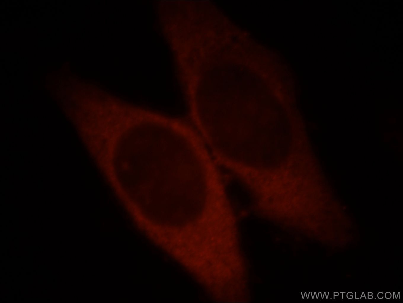 Immunofluorescence (IF) / fluorescent staining of HepG2 cells using Catalase-Specific Polyclonal antibody (19792-1-AP)