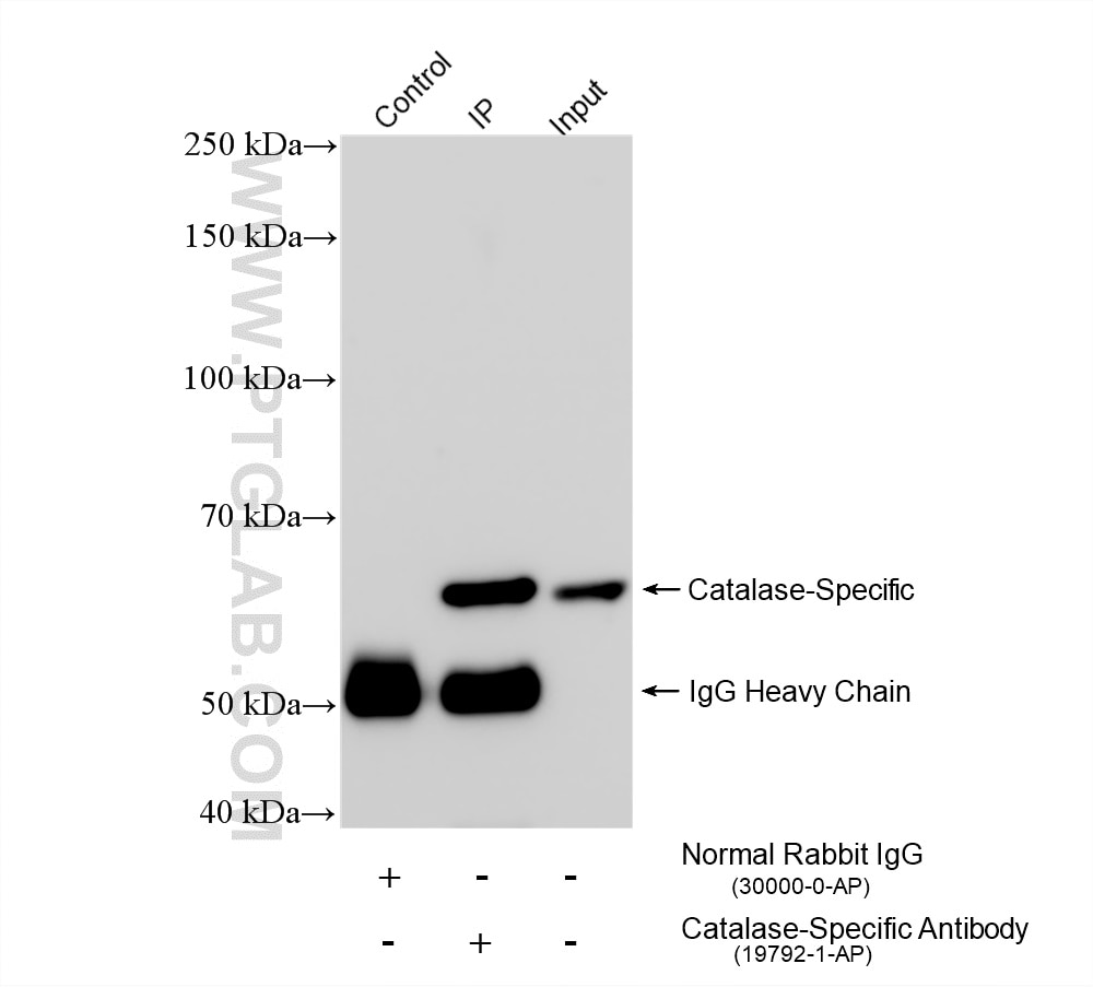 Immunoprecipitation (IP) experiment of HeLa cells using Catalase-Specific Polyclonal antibody (19792-1-AP)