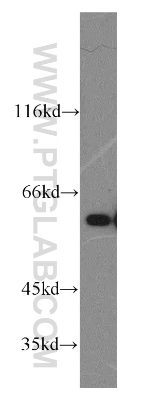 Western Blot (WB) analysis of HeLa cells using Catalase-Specific Polyclonal antibody (19792-1-AP)
