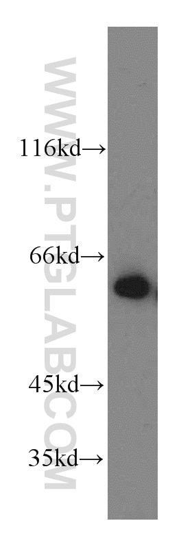 Western Blot (WB) analysis of HeLa cells using Catalase-Specific Polyclonal antibody (19792-1-AP)