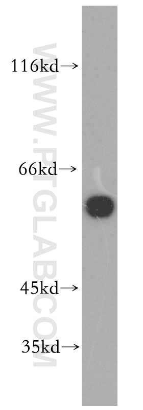 Western Blot (WB) analysis of HT-1080 cells using Catalase-Specific Polyclonal antibody (19792-1-AP)