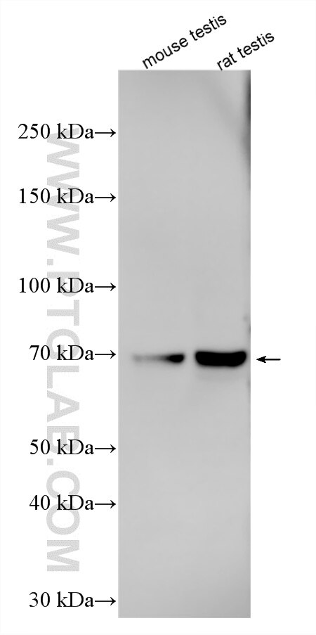 WB analysis using 26890-1-AP (same clone as 26890-1-PBS) Western Blot (WB) analysis of various lysates using CATSPER2 Polyclonal antibody (26890-1-AP)