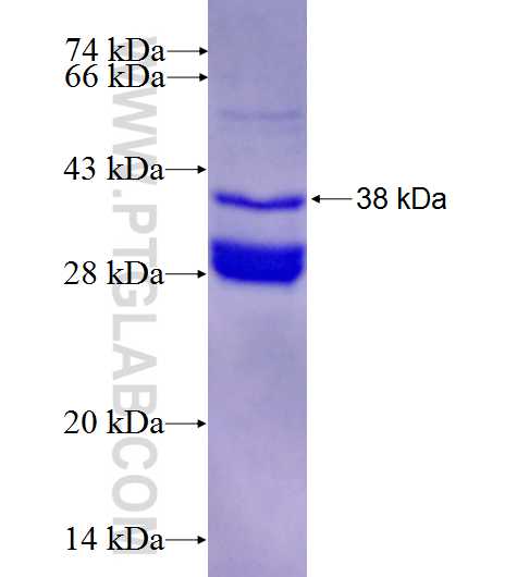 CATSPER2 fusion protein Ag25283 SDS-PAGE