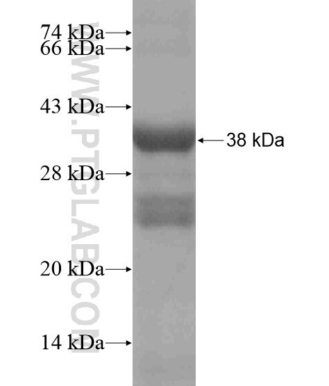 CATSPER4 fusion protein Ag19170 SDS-PAGE
