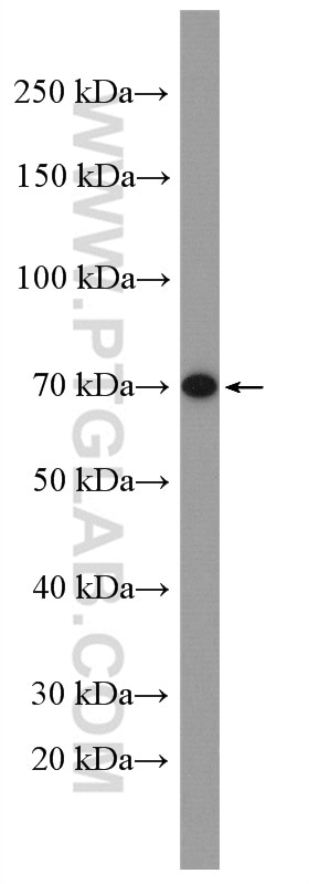 Western Blot (WB) analysis of mouse liver tissue using CATSPERB Polyclonal antibody (26633-1-AP)