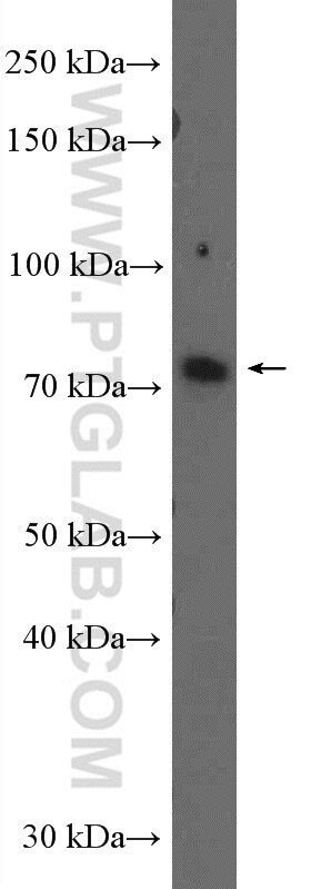 WB analysis of L02 using 26633-1-AP