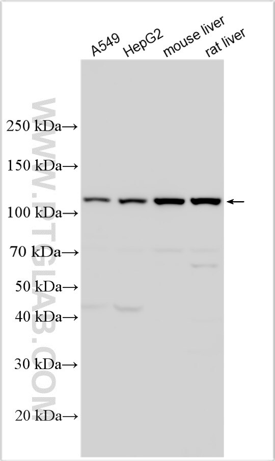 WB analysis using 32840-1-AP Western Blot (WB) analysis of various lysates using CATSPERE Polyclonal antibody (32840-1-AP)