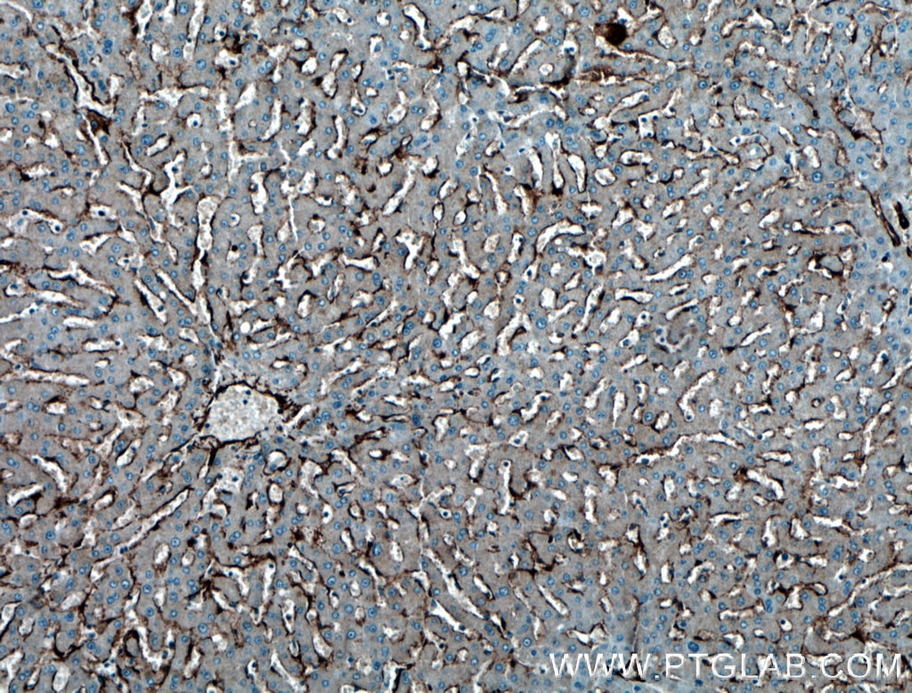 Immunohistochemistry (IHC) staining of human liver tissue using Caveolin-1 Polyclonal antibody (16447-1-AP)