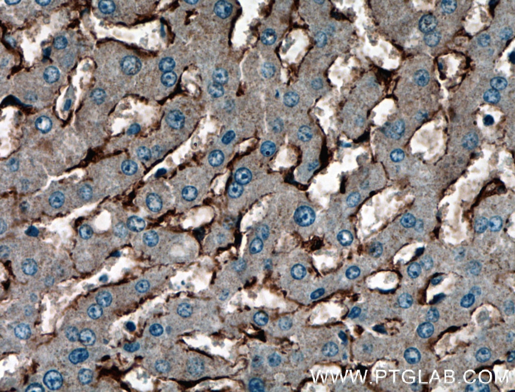 Immunohistochemistry (IHC) staining of human liver tissue using Caveolin-1 Polyclonal antibody (16447-1-AP)