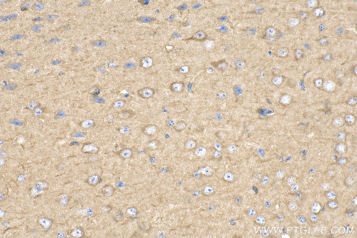 Immunohistochemistry (IHC) staining of mouse brain tissue using Caveolin-1 Polyclonal antibody (16447-1-AP)