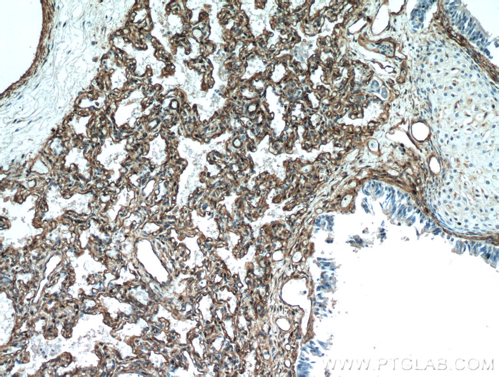 Immunohistochemistry (IHC) staining of human lung tissue using Caveolin-1 Polyclonal antibody (16447-1-AP)