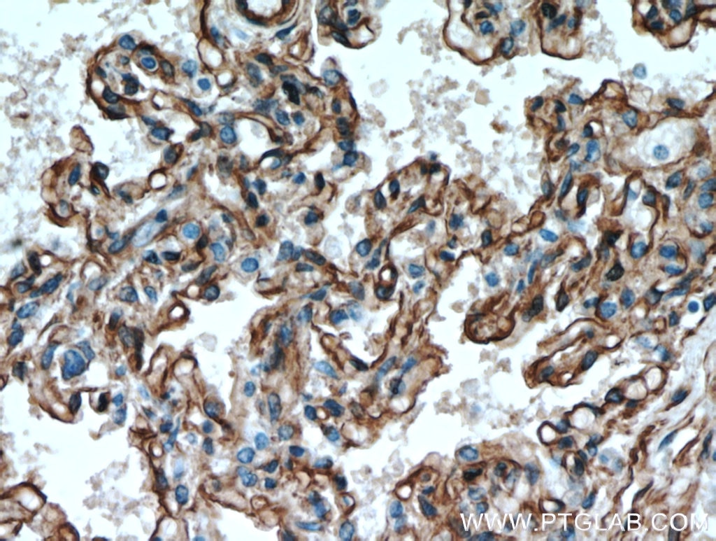 Immunohistochemistry (IHC) staining of human lung tissue using Caveolin-1 Polyclonal antibody (16447-1-AP)