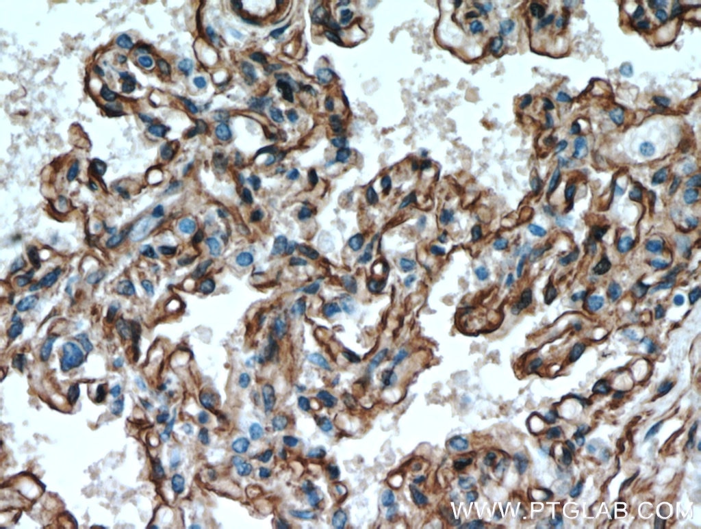 Caveolin-1 Polyclonal antibody