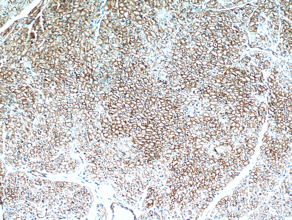 Immunohistochemistry (IHC) staining of human heart tissue using Caveolin-1 Polyclonal antibody (16447-1-AP)