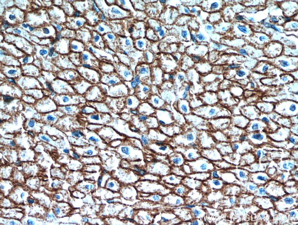 Immunohistochemistry (IHC) staining of human heart tissue using Caveolin-1 Polyclonal antibody (16447-1-AP)