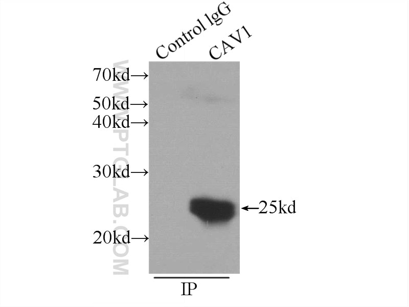 Immunoprecipitation (IP) experiment of A549 cells using Caveolin-1 Polyclonal antibody (16447-1-AP)