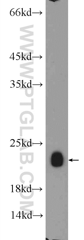 Caveolin-1 Polyclonal antibody