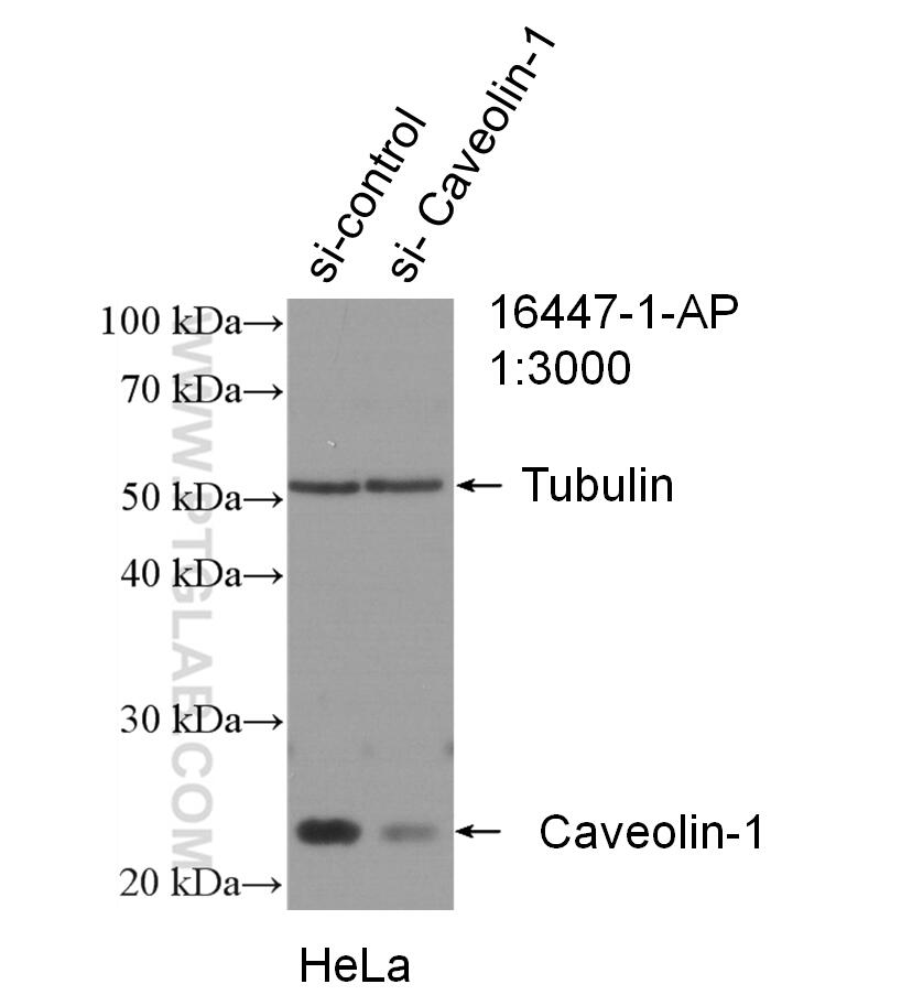 Western Blot (WB) analysis of HeLa cells using Caveolin-1 Polyclonal antibody (16447-1-AP)