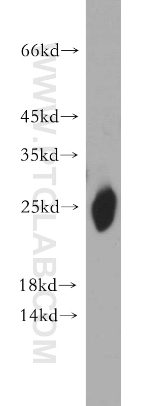 Caveolin-1 Polyclonal antibody