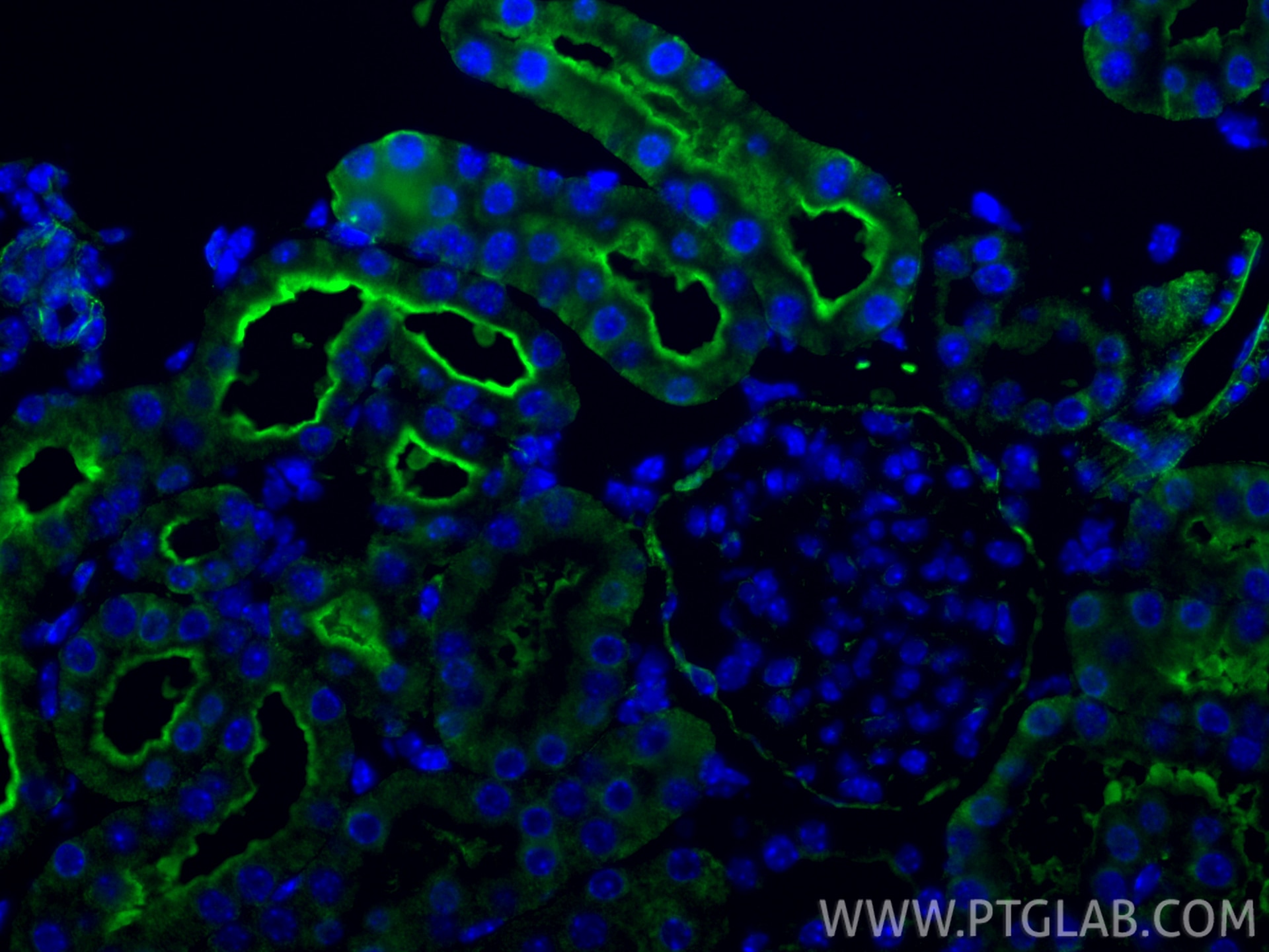 Immunofluorescence (IF) / fluorescent staining of mouse kidney tissue using Caveolin-1 Monoclonal antibody (66067-1-Ig)