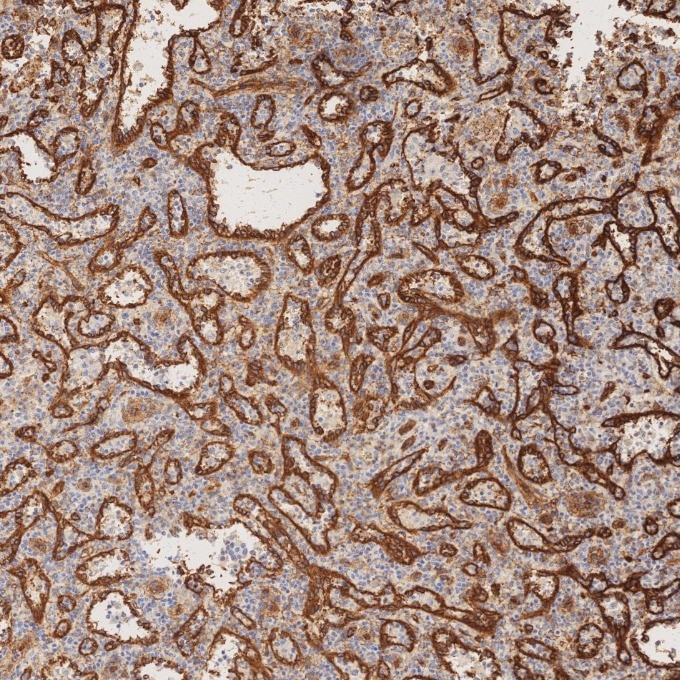 Immunohistochemistry (IHC) staining of human spleen tissue using Caveolin-1 Monoclonal antibody (66067-1-Ig)