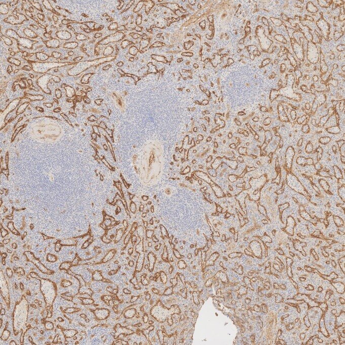 Immunohistochemistry (IHC) staining of human spleen tissue using Caveolin-1 Monoclonal antibody (66067-1-Ig)