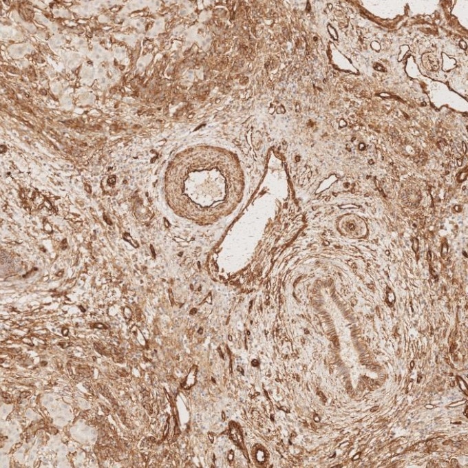 Immunohistochemistry (IHC) staining of human liver tissue using Caveolin-1 Monoclonal antibody (66067-1-Ig)
