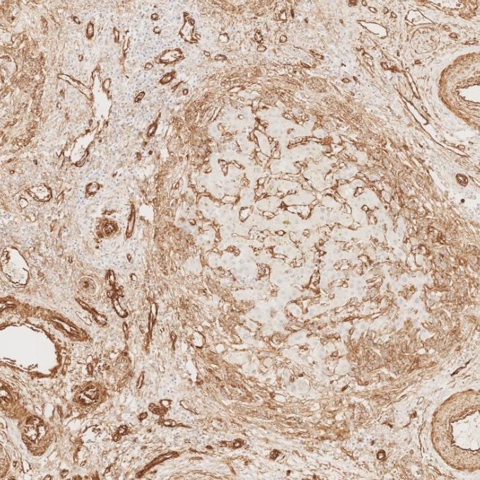 Immunohistochemistry (IHC) staining of human liver tissue using Caveolin-1 Monoclonal antibody (66067-1-Ig)