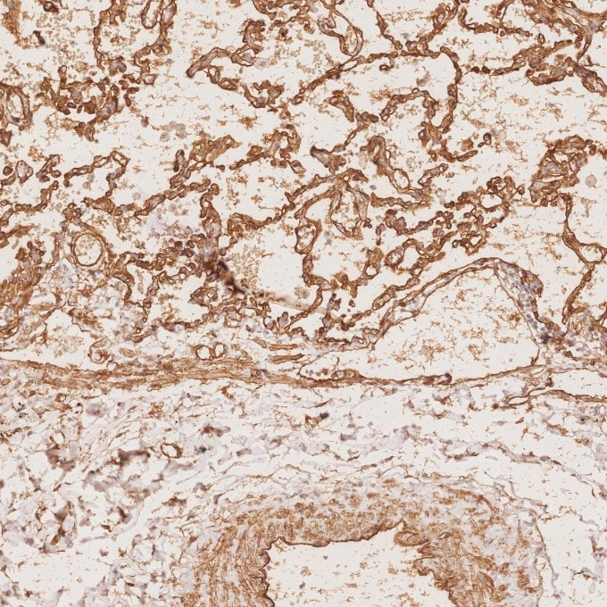 Immunohistochemistry (IHC) staining of human lung tissue using Caveolin-1 Monoclonal antibody (66067-1-Ig)