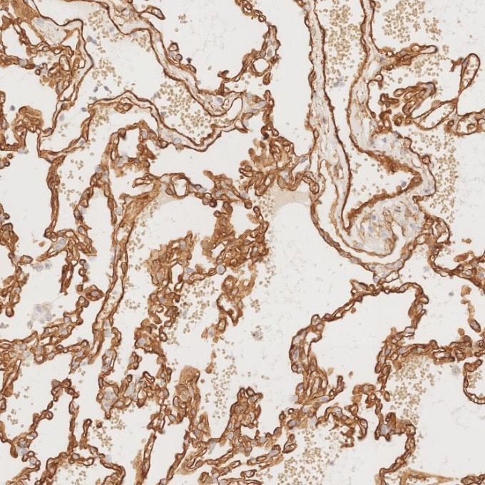 Immunohistochemistry (IHC) staining of human lung tissue using Caveolin-1 Monoclonal antibody (66067-1-Ig)