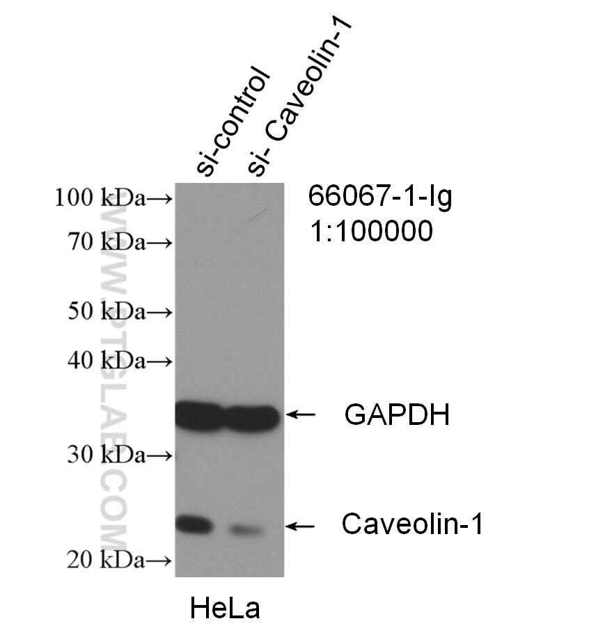 Western Blot (WB) analysis of HeLa cells using Caveolin-1 Monoclonal antibody (66067-1-Ig)