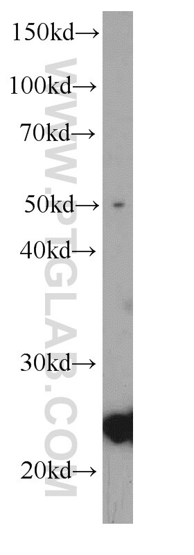 Caveolin-1 Monoclonal antibody