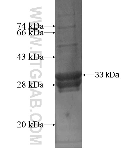 CAV1 fusion protein Ag10924 SDS-PAGE