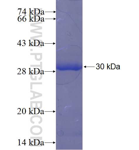 CBARA1 fusion protein Ag23176 SDS-PAGE