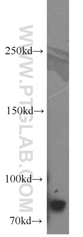 Western Blot (WB) analysis of HeLa cells using CBFA2T2 Polyclonal antibody (11336-1-AP)