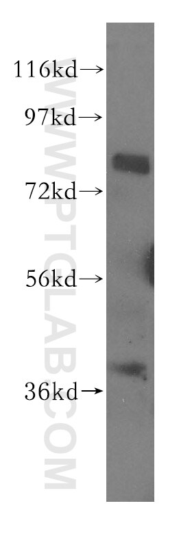 Western Blot (WB) analysis of mouse testis tissue using CBFA2T2 Polyclonal antibody (11336-1-AP)