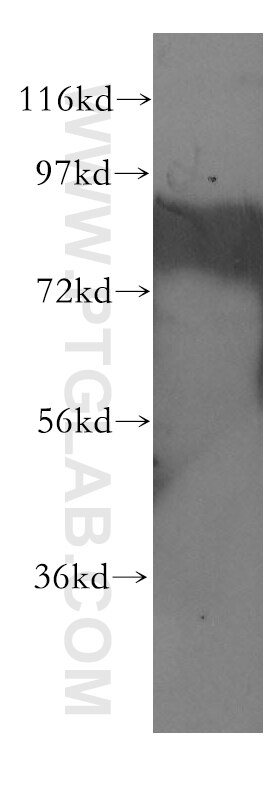 Western Blot (WB) analysis of HEK-293 cells using CBFA2T2 Polyclonal antibody (11336-1-AP)