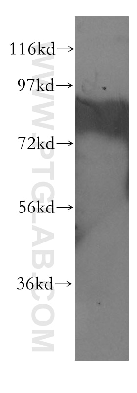 Western Blot (WB) analysis of HEK-293 cells using CBFA2T2 Polyclonal antibody (11336-1-AP)