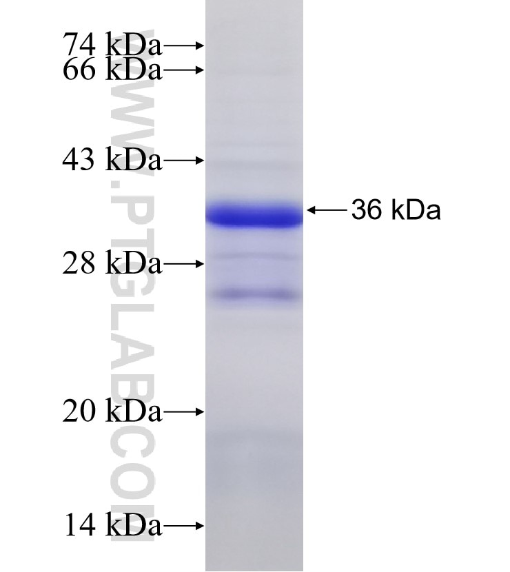 CBFA2T2 fusion protein Ag33484 SDS-PAGE CBFA2T2 fusion protein Ag33484 SDS-PAGE