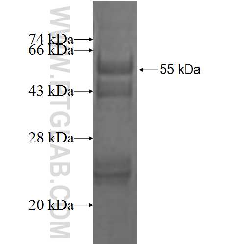 CBFA2T2 fusion protein Ag1880 SDS-PAGE