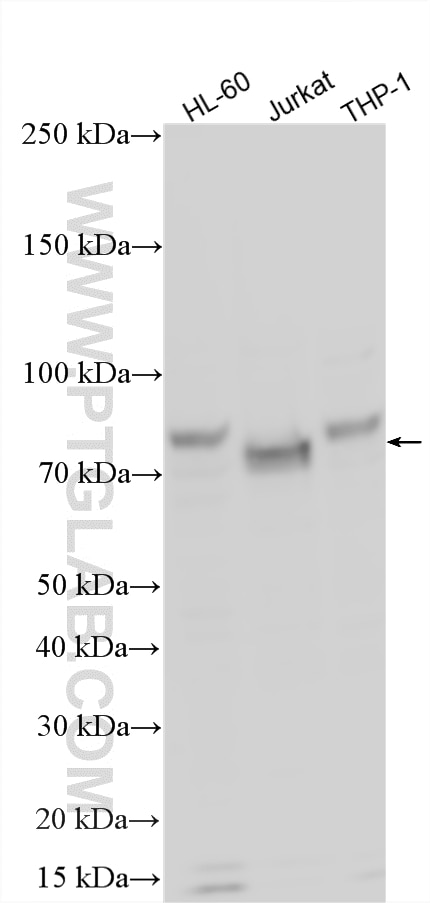 WB analysis using 17190-1-AP Western Blot (WB) analysis of various lysates using CBFA2T3 Polyclonal antibody (17190-1-AP)