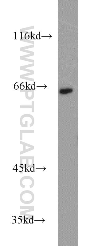 Western Blot (WB) analysis of Jurkat cells using CBFA2T3 Polyclonal antibody (17190-1-AP)