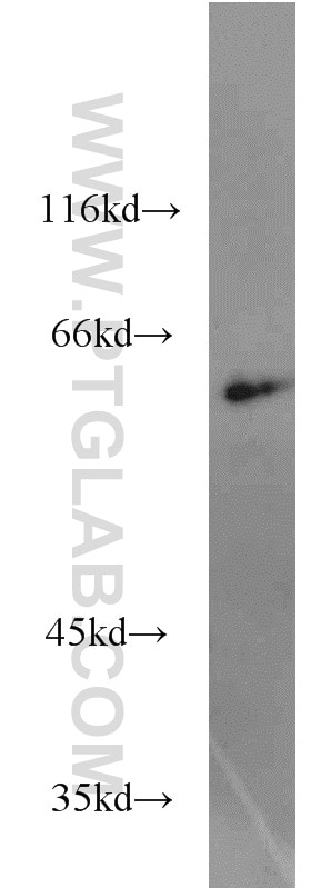 Western Blot (WB) analysis of Jurkat cells using CBFA2T3 Polyclonal antibody (17190-1-AP)