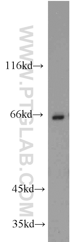 Western Blot (WB) analysis of Jurkat cells using CBFA2T3 Polyclonal antibody (17190-1-AP)