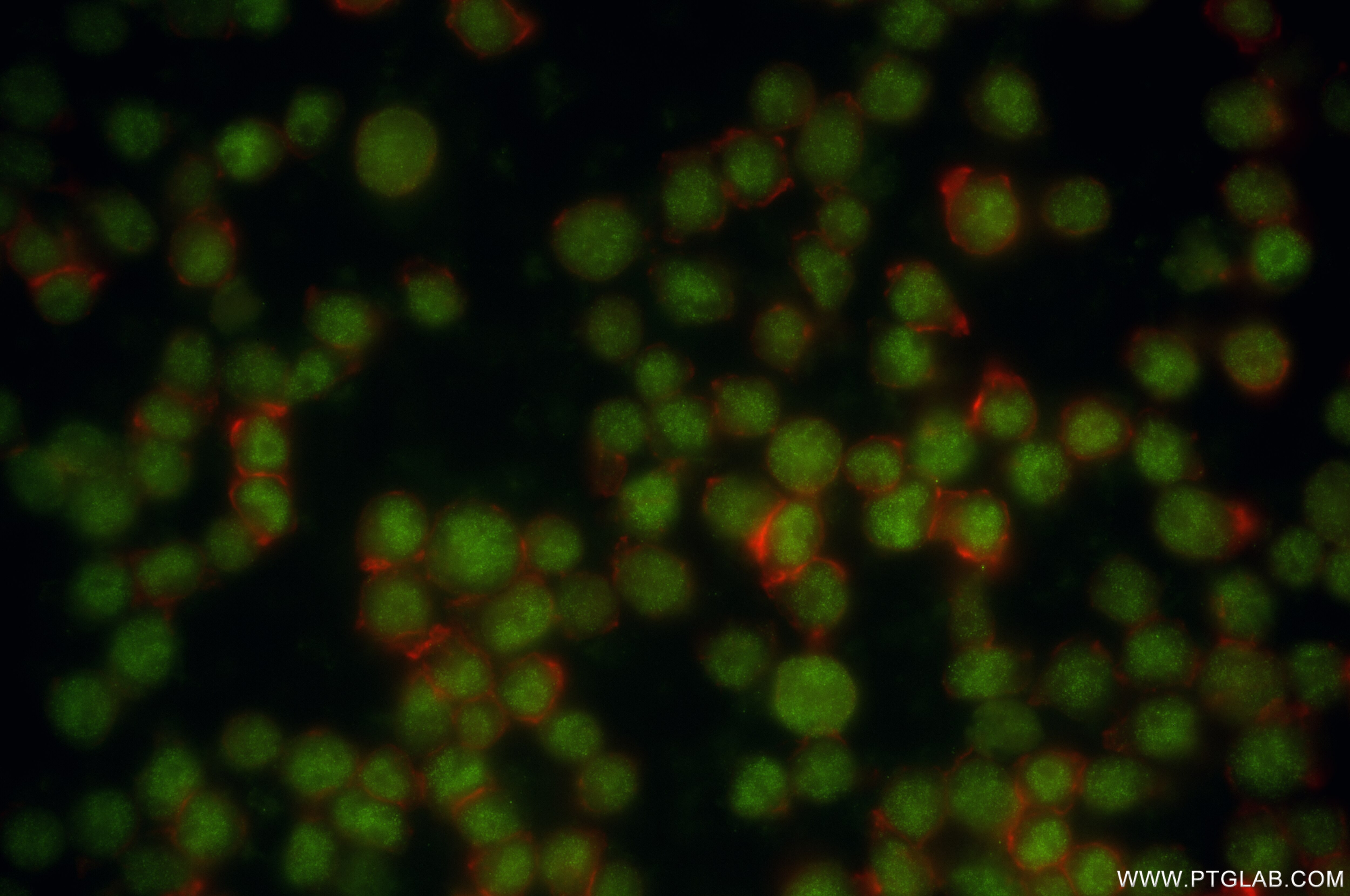 Immunofluorescence (IF) / fluorescent staining of Jurkat cells using CBFA2T3 Recombinant antibody (86198-4-RR)
