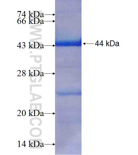 CBFA2T3 fusion protein Ag9148 SDS-PAGE